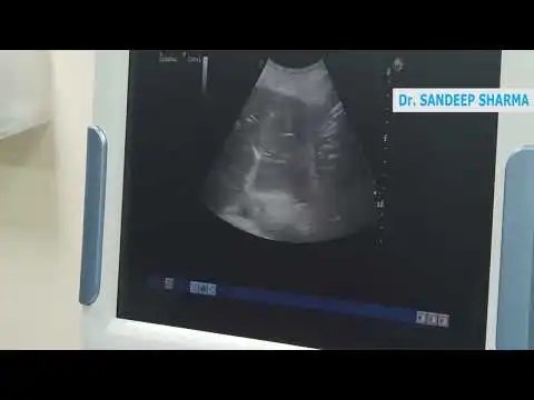 Multiple Liver Metastasis Ablation